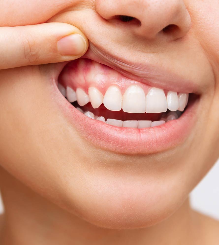 Periodoncia